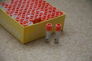 鳞癌,良恶性腺涎肿瘤,癌前病变组织;口腔颌面部肿瘤患者冻存外周血